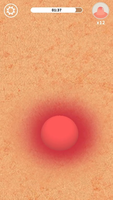 我挤痘痘贼6(Acne Survival)