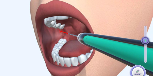 牙医模拟器中文版游戏特色