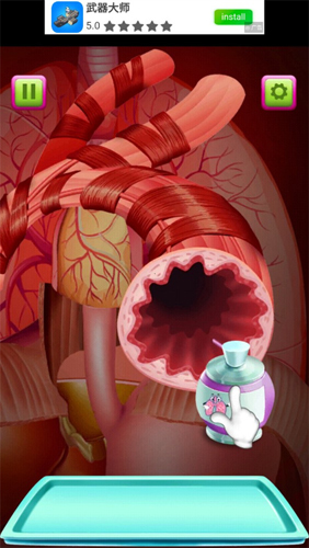 外科医生模拟器破解版新手指南7